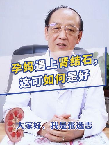 代怀助孕肾结石的诊疗策略